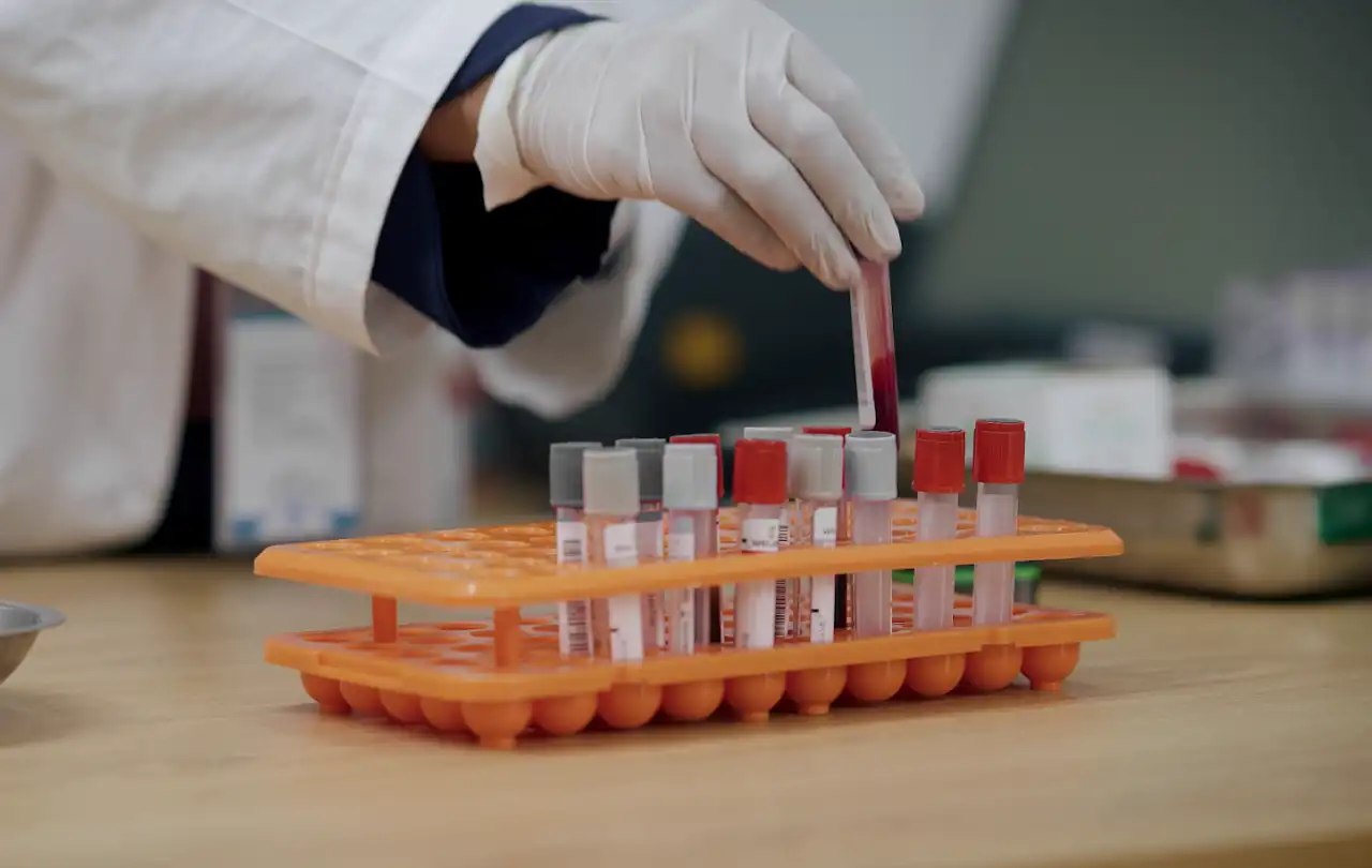 Sample Organizing