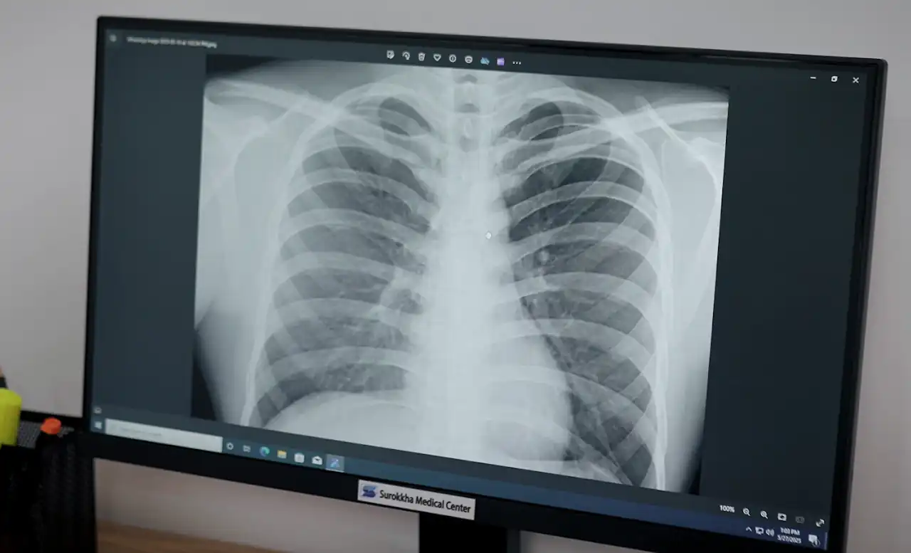 X-ray Display