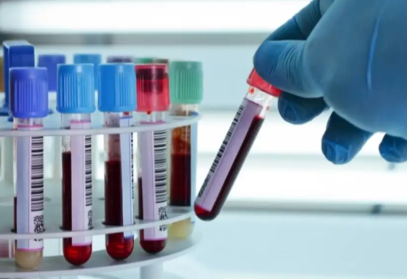Serology Lab